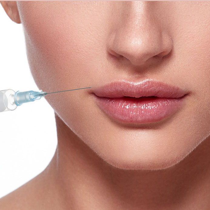 Juvederm-Ultra-Plus-XC-–-1cc-syringe